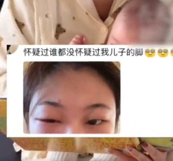 吴悦菡闻孩子脚丫导致眼睛感染 确诊细菌性结膜炎