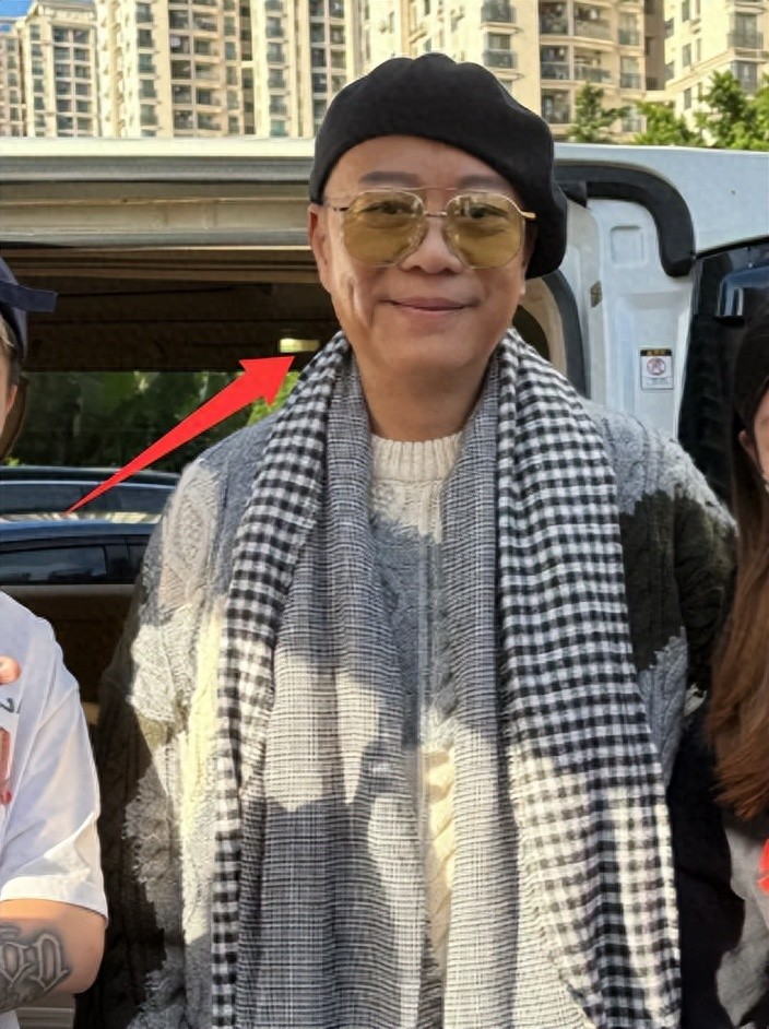 TVB视帝亮相广州，眼圈肿胀为粉丝签名，自曝曾因脸“生蛇”崩溃封面图